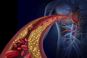 bad cholesterol